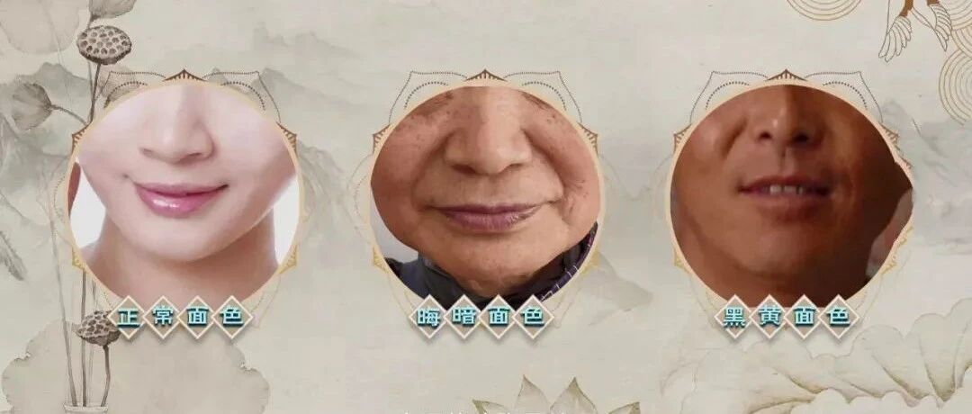 千万别轻视痰瘀互结，心梗、脑梗、甚至猝死背后都见它！丨健康之路