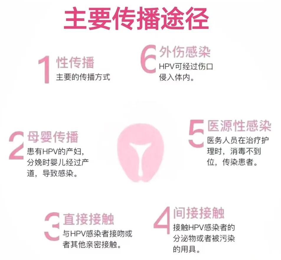 人乳头瘤病毒是什么意思