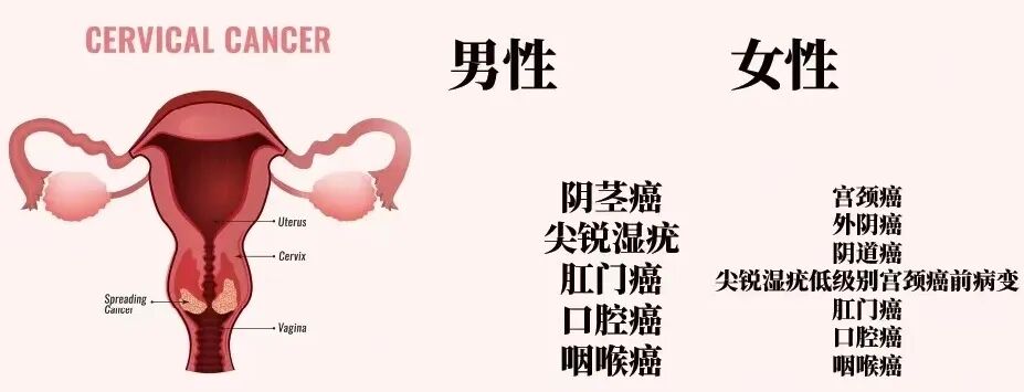 人乳头瘤病毒是什么意思