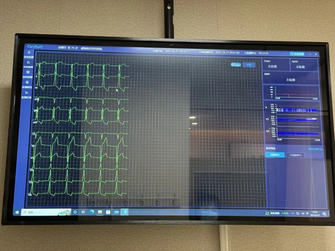心电监护怎么开24h在线 ｜利民医院远程实时心电监护开启“云端”护心模式！_https://www.jmylbn.com_新闻资讯_第6张