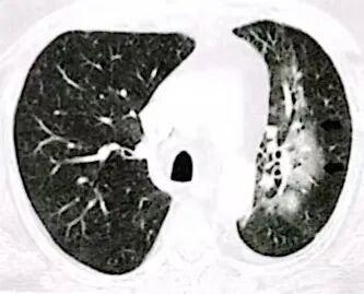 cbfec6e25e35575ba5df90234a61d745