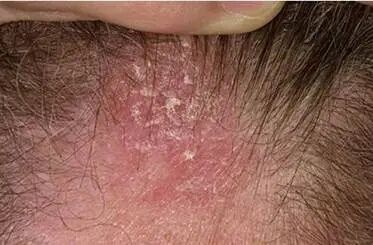 9e6e3867369320e43f1e85f9956eb817