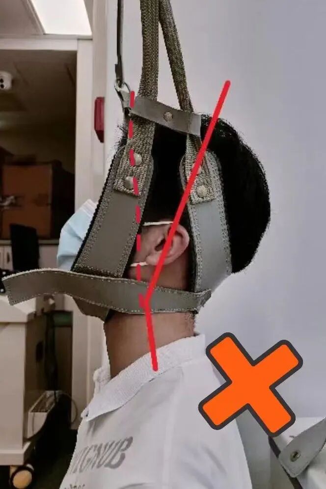 怎么选择家用颈椎牵引在家“吊脖子”治颈椎病，真的靠谱吗？_https://www.jmylbn.com_新闻资讯_第7张