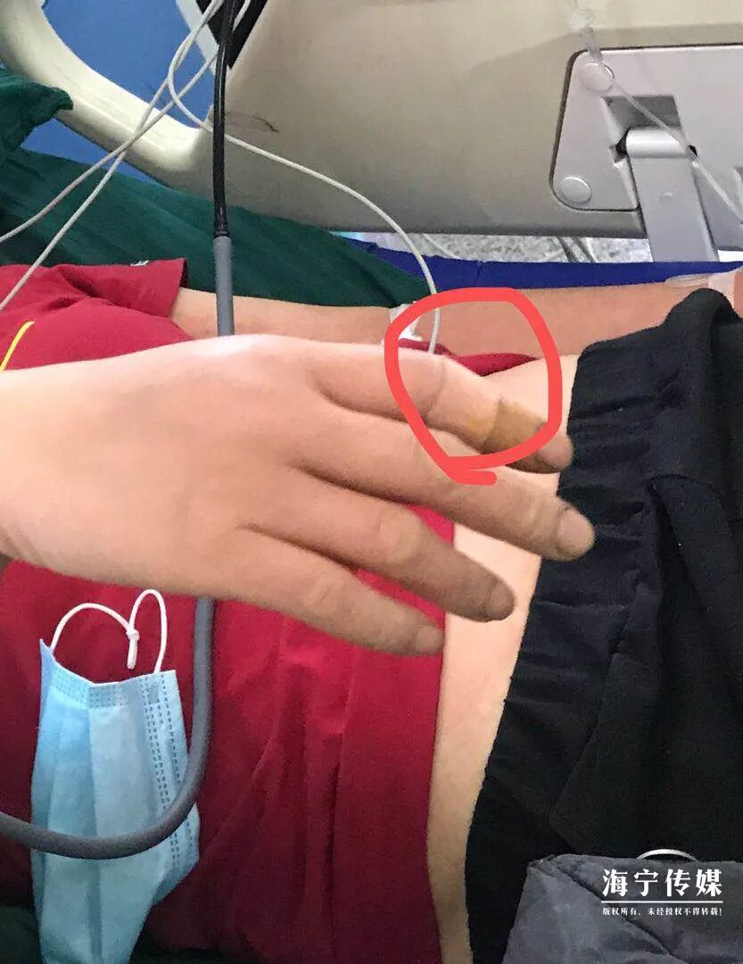 没想到缝缝里藏了个蜈蚣,它把我手套咬破了,咬到了我的手……"医生