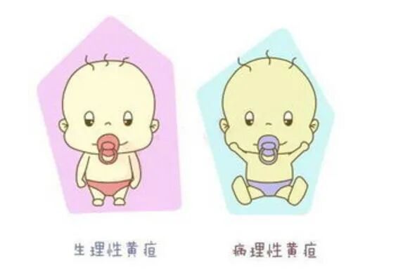 为什么要用光疗纸尿裤小宝贝黄疸不用母婴分离了——厦门大学附属第一医院同安院区日间光疗病房_https://www.jmylbn.com_新闻资讯_第3张