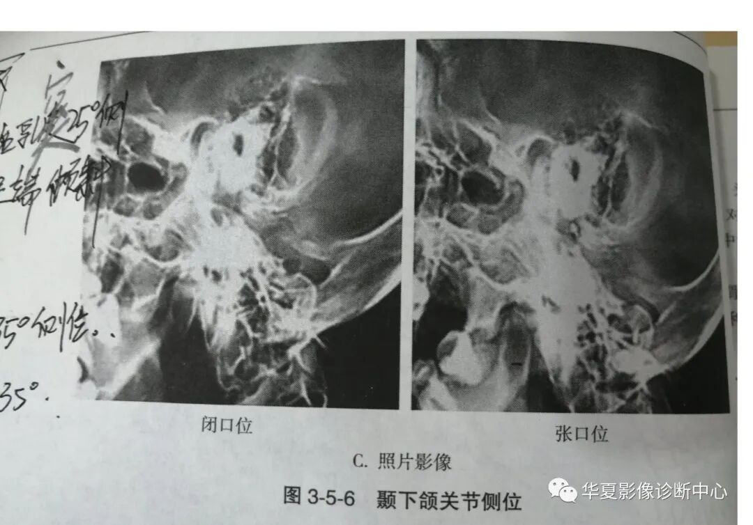 dr拍片怎么拍清晰DR 摄影部位大全_https://www.jmylbn.com_新闻资讯_第11张