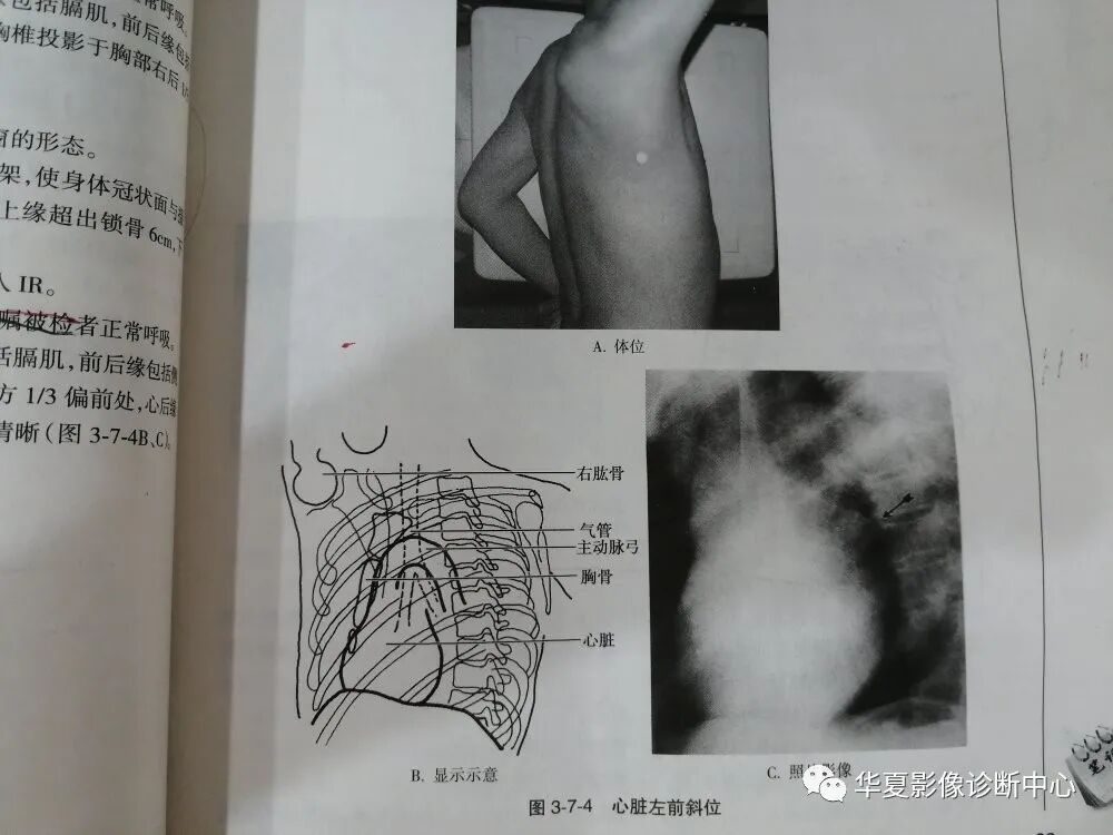 dr拍片怎么拍清晰DR 摄影部位大全_https://www.jmylbn.com_新闻资讯_第19张