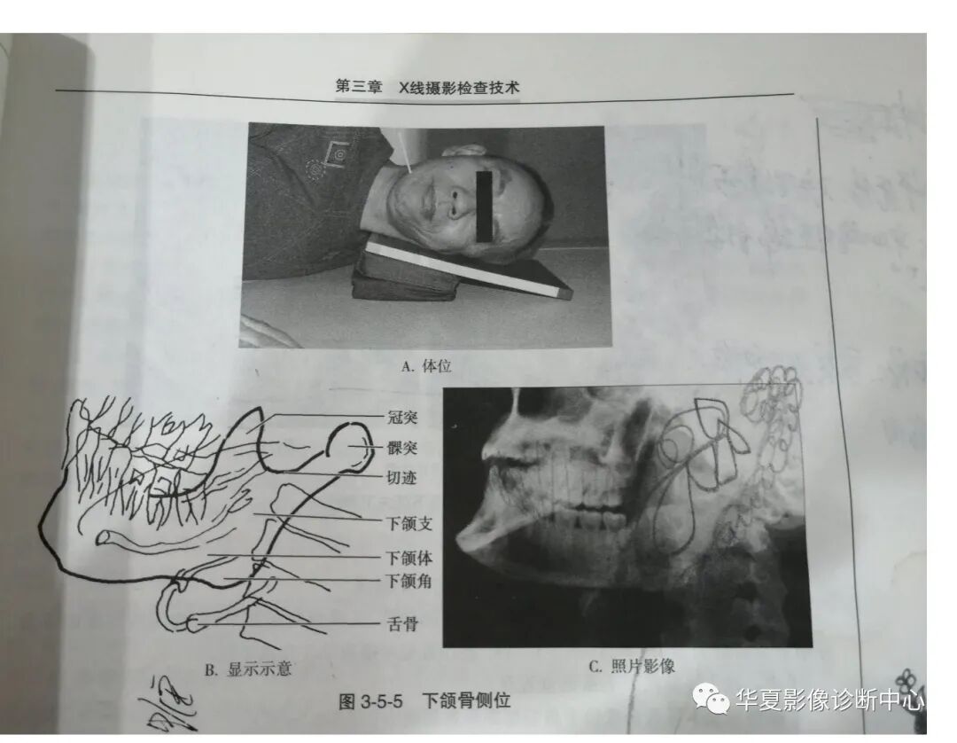 dr拍片怎么拍清晰DR 摄影部位大全_https://www.jmylbn.com_新闻资讯_第9张