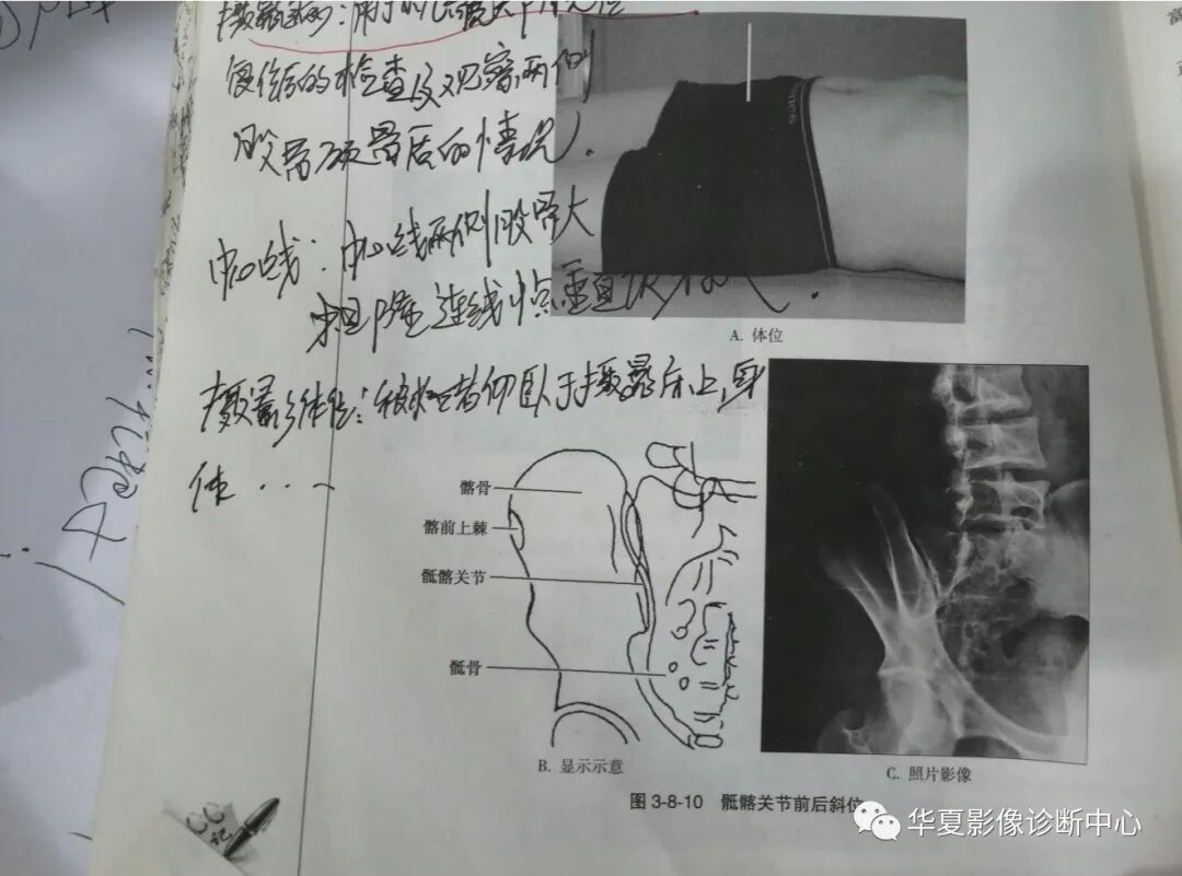 dr拍片怎么拍清晰DR 摄影部位大全_https://www.jmylbn.com_新闻资讯_第24张