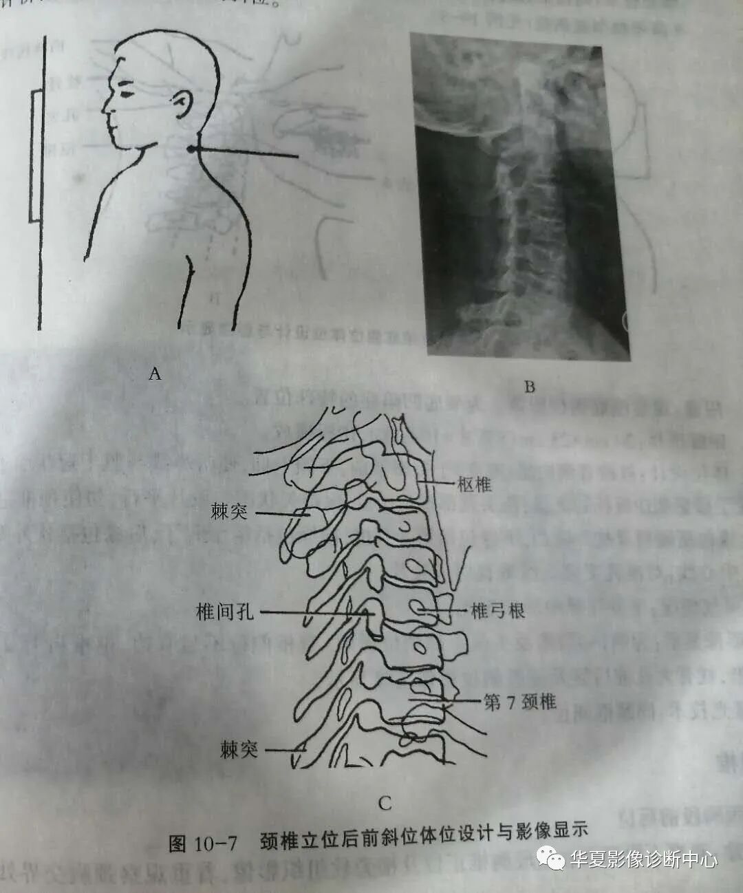 颈椎阅片你知道几种