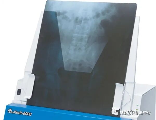 医用胶片怎么处理为什么医用影像胶片全球统一“暗蓝黑色”？    彩蛋：影像医师读片的最佳条件。_https://www.jmylbn.com_新闻资讯_第4张