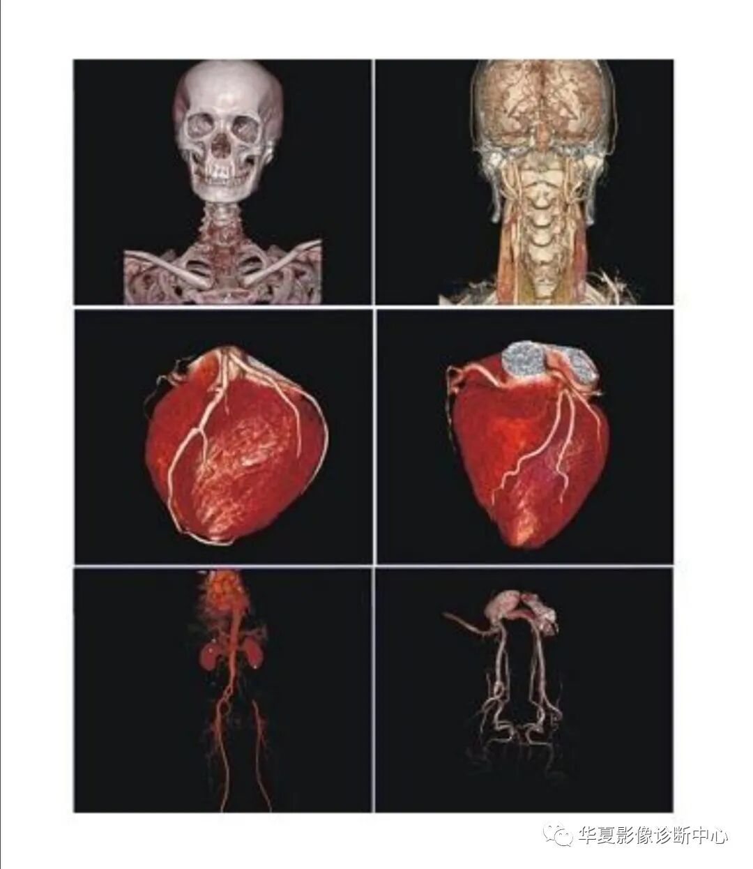 医用胶片怎么处理为什么医用影像胶片全球统一“暗蓝黑色”？    彩蛋：影像医师读片的最佳条件。_https://www.jmylbn.com_新闻资讯_第10张