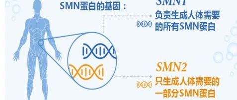 cover_image