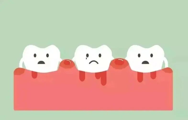 牙齿发出这7个求救信号时一定要重视