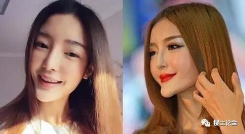 Somaderm HGH凝胶最低性价比的享受医美抗衰老福利