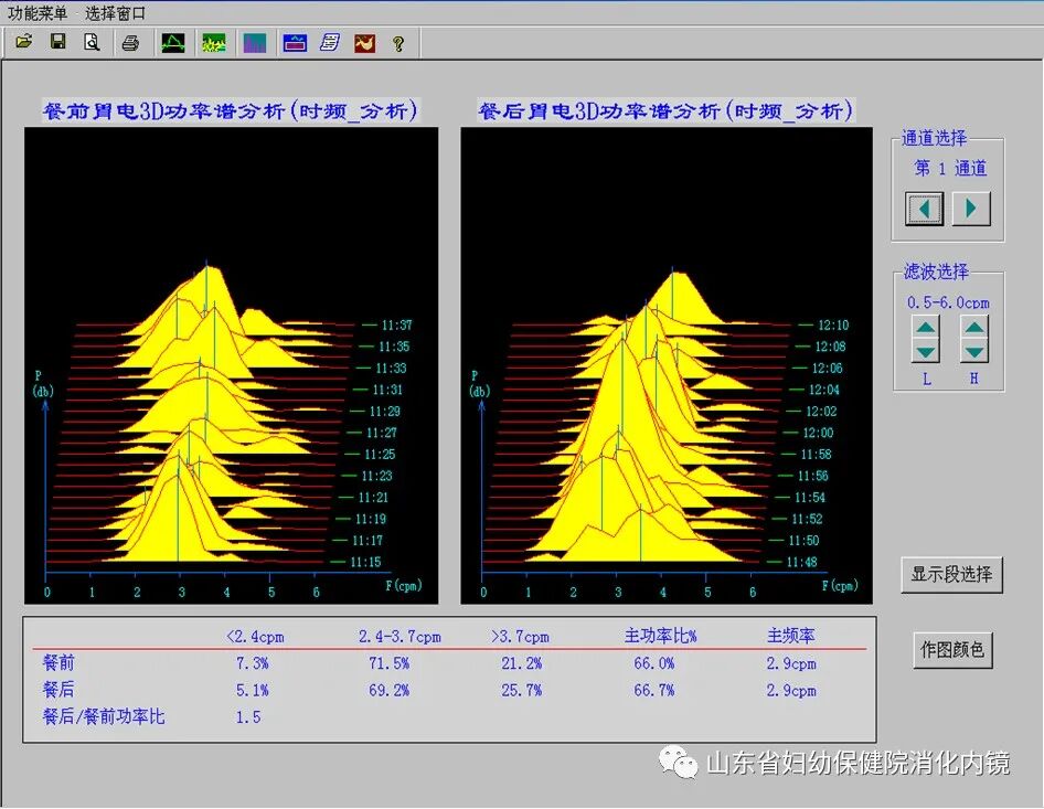 肠电图能查看什么了解您的胃肠功能，胃肠电图来帮忙！_https://www.jmylbn.com_新闻资讯_第10张