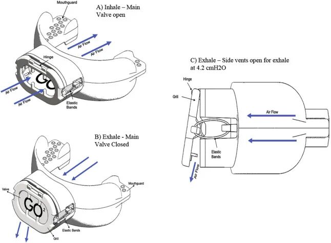 peep阀怎么使用可穿戴呼气末正压阀可提高运动表现_https://www.jmylbn.com_新闻资讯_第2张
