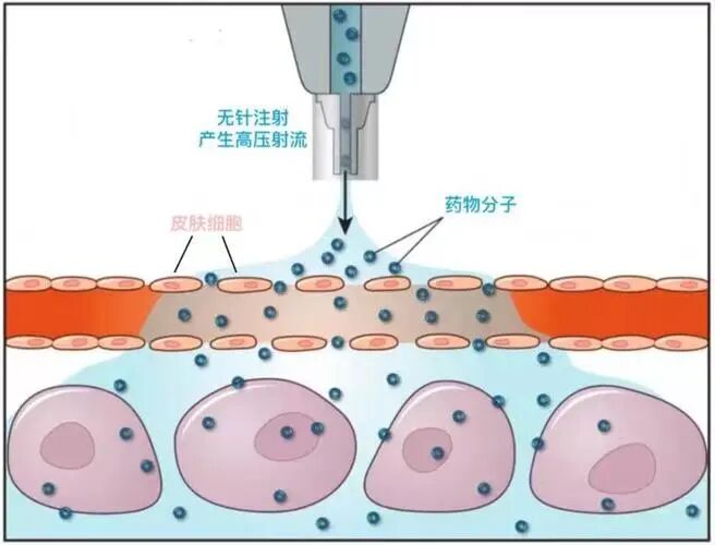 为什么叫一次性注射器什么？以前打针用的针筒，竟是动物膀胱？_https://www.jmylbn.com_新闻资讯_第5张