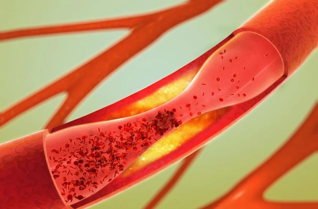 不止降糖！列净类药物暗藏