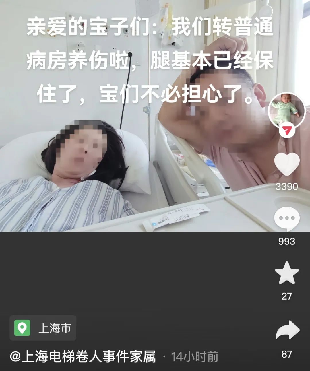 腿基本保住了！上海女子卷入扶梯险遭截肢，如今已转出ICU！