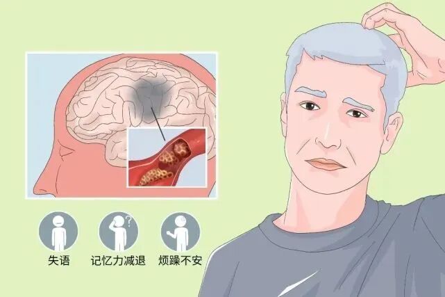 tms什么医疗【健康科普】安全有效的物理治疗——经颅磁刺激技术（TMS）_https://www.jmylbn.com_新闻资讯_第7张