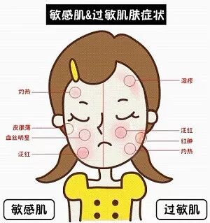 甲醛超标身体初期有哪些反应？不要后悔晚矣！(图4)