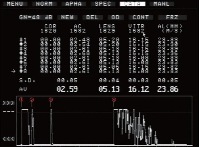 眼科ab超怎么操作了解眼科检查——A型超声_https://www.jmylbn.com_新闻资讯_第5张