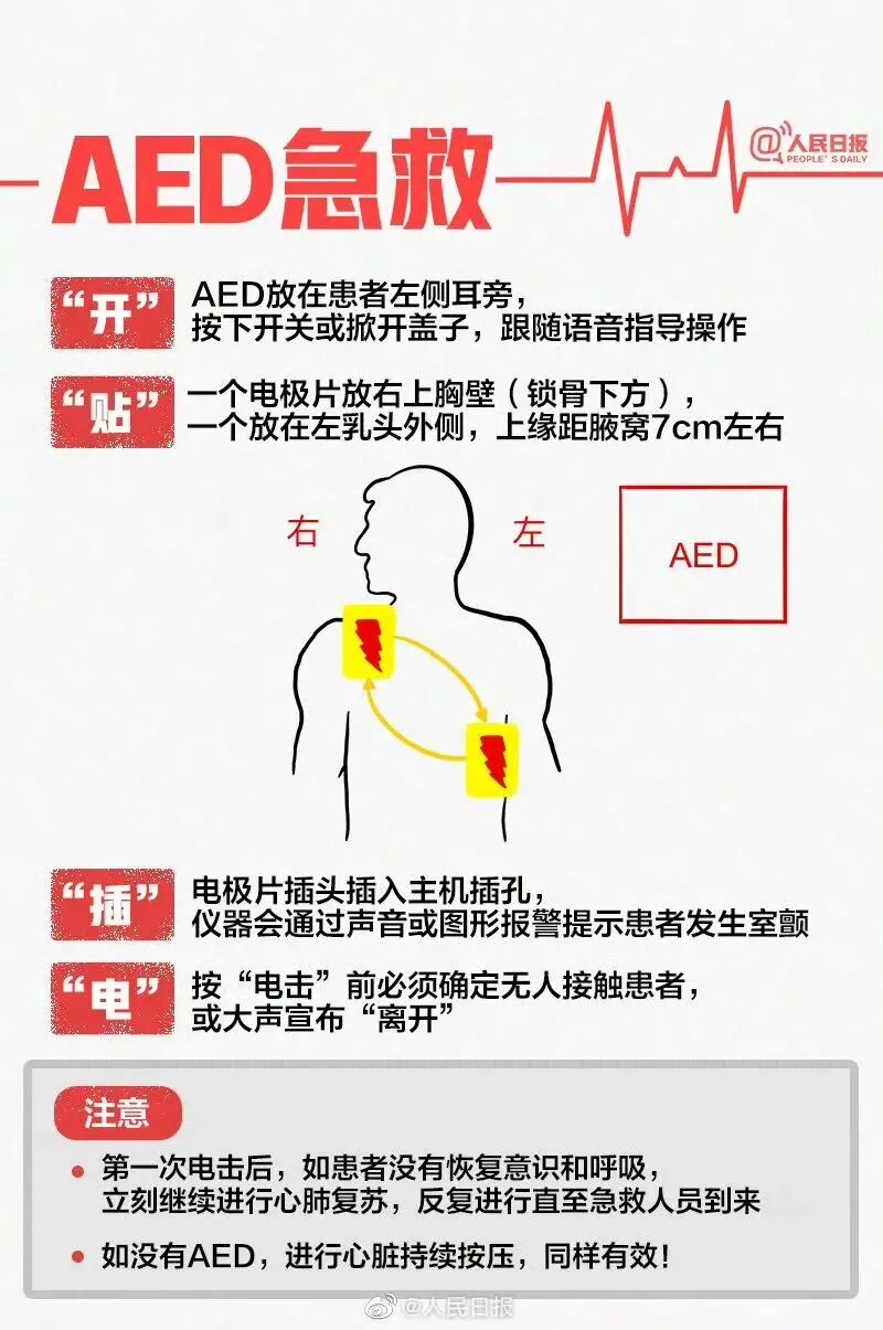 cpr按压板怎么用学会心肺复苏术，关键时刻能救命_https://www.jmylbn.com_新闻资讯_第18张