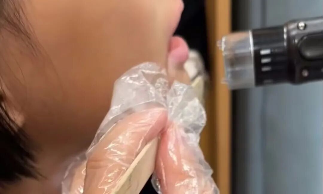 4006B光疗怎么用治疗白癜风时，家用308与医院308光疗有什么区别？为什么建议去医院治疗_https://www.jmylbn.com_新闻资讯_第8张