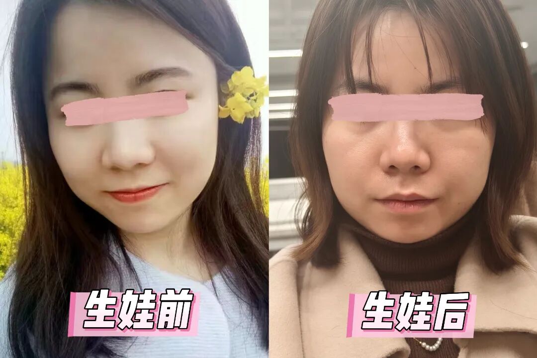绽媄娅的产品怎么样比买包爽100倍！糕妈的“医美平替”太绝了！素颜年轻5岁，连老公都夸认不出_https://www.jmylbn.com_新闻资讯_第1张