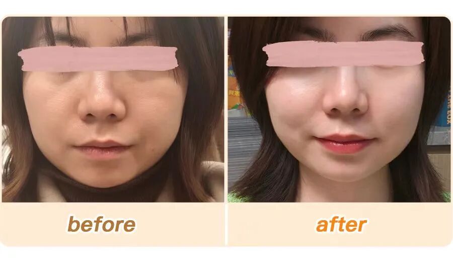 绽媄娅的产品怎么样比买包爽100倍！糕妈的“医美平替”太绝了！素颜年轻5岁，连老公都夸认不出_https://www.jmylbn.com_新闻资讯_第26张