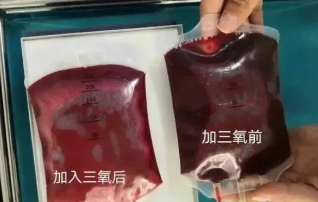 臭氧治疗什么病“臭氧”究竟靠什么治疗这么多疾病？_https://www.jmylbn.com_新闻资讯_第8张