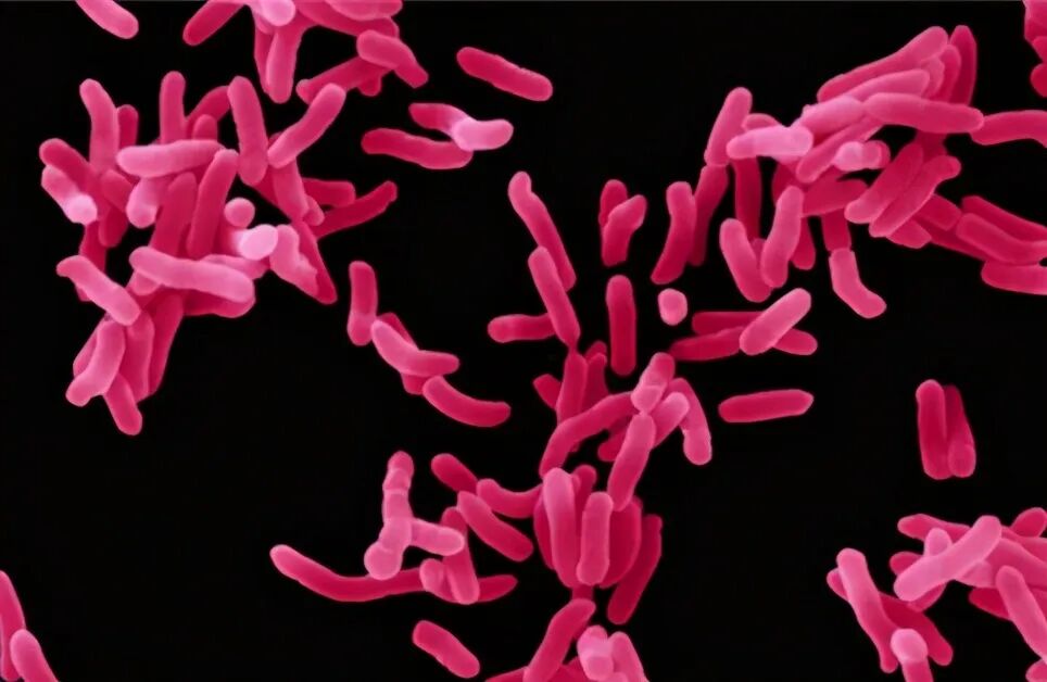 检验科新项目——革兰阴性菌脂多糖检测