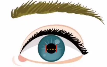 眼科a超单数据怎么看孩子近视的秘密代码，都在一张图中_https://www.jmylbn.com_新闻资讯_第16张