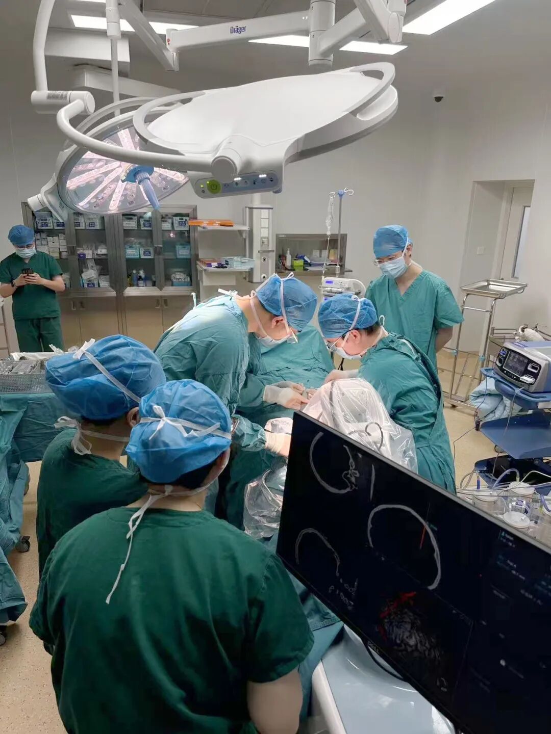 日本光电脑电图怎么样神经外科机器人精准定位治疗难治性癫痫_https://www.jmylbn.com_新闻资讯_第2张