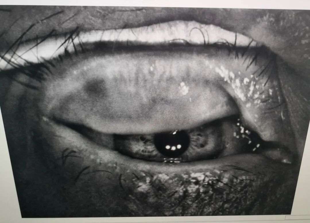 光热治疗仪有什么作用厦门眼科中心“睑板腺光热脉动VIP复合治疗仪全国培训中心”成立！引领干眼规范化诊疗迈进新高度_https://www.jmylbn.com_新闻资讯_第2张