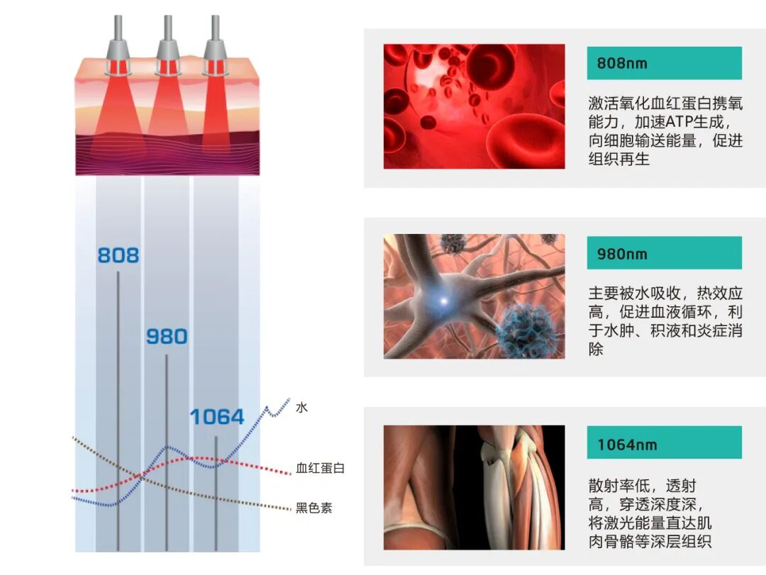 康复治疗激光怎么收费【高能量激光】康复与疼痛治疗的＂无痛修复术＂——给饱受疼痛困扰患者的科学指南_https://www.jmylbn.com_新闻资讯_第1张