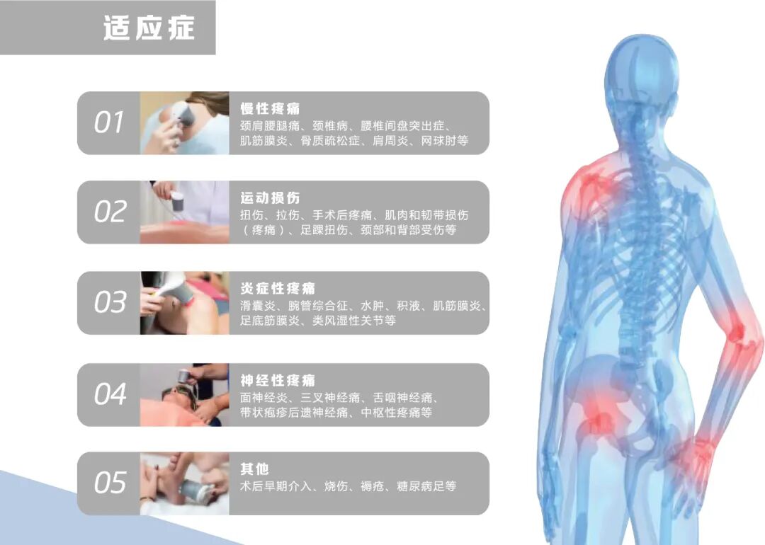 康复治疗激光怎么收费【高能量激光】康复与疼痛治疗的＂无痛修复术＂——给饱受疼痛困扰患者的科学指南_https://www.jmylbn.com_新闻资讯_第4张