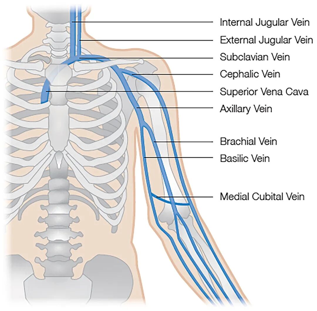 医学上ipc是什么米国静脉论坛上肢深静脉血栓临床指南与深度解析_https://www.jmylbn.com_新闻资讯_第13张