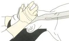 为什么要用喉罩科普｜ 如何正确使用喉罩_https://www.jmylbn.com_新闻资讯_第9张