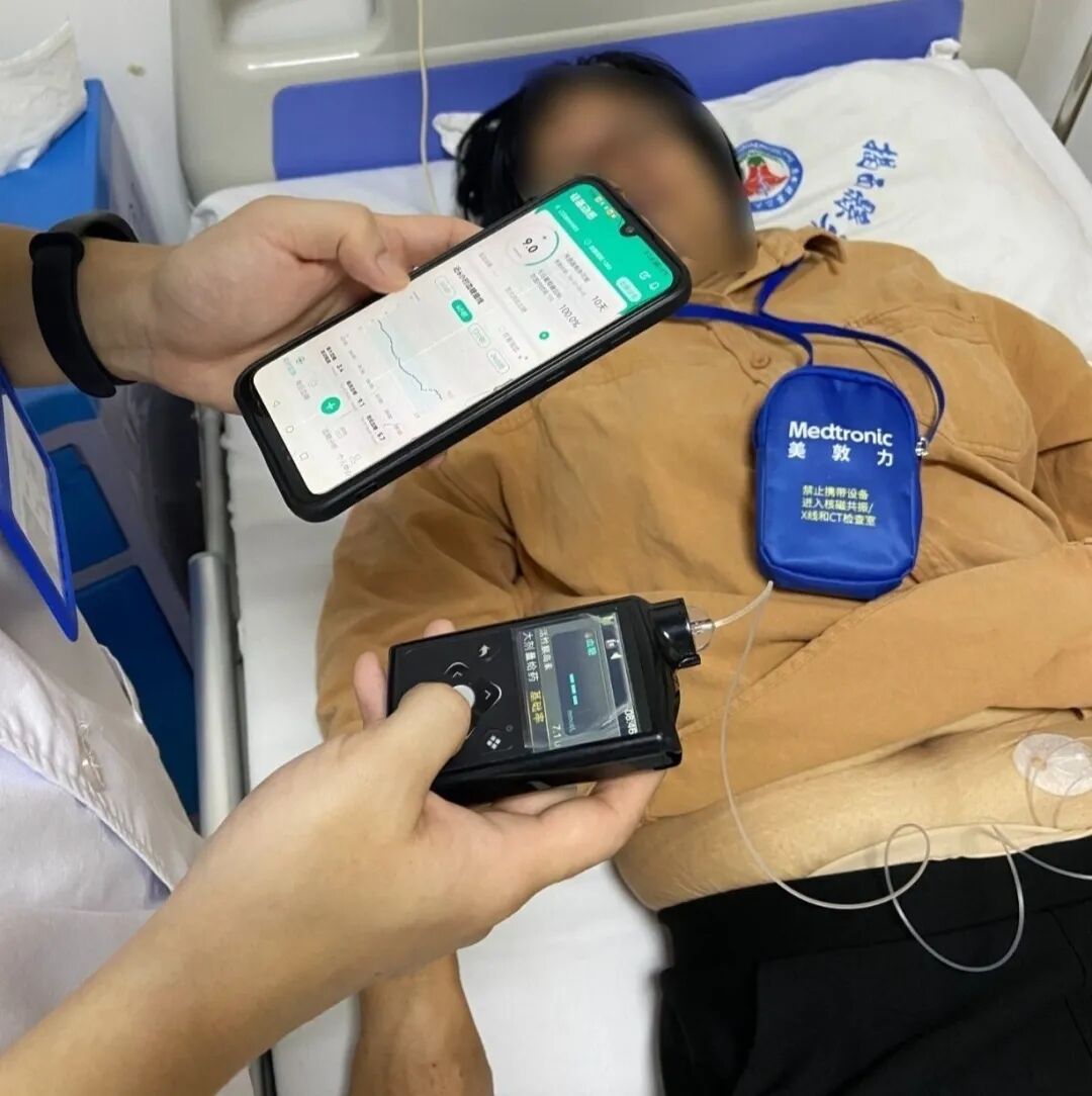 为什么要用泵打针智能控糖先锋——胰岛素泵，助您精准控糖无忧！_https://www.jmylbn.com_新闻资讯_第10张