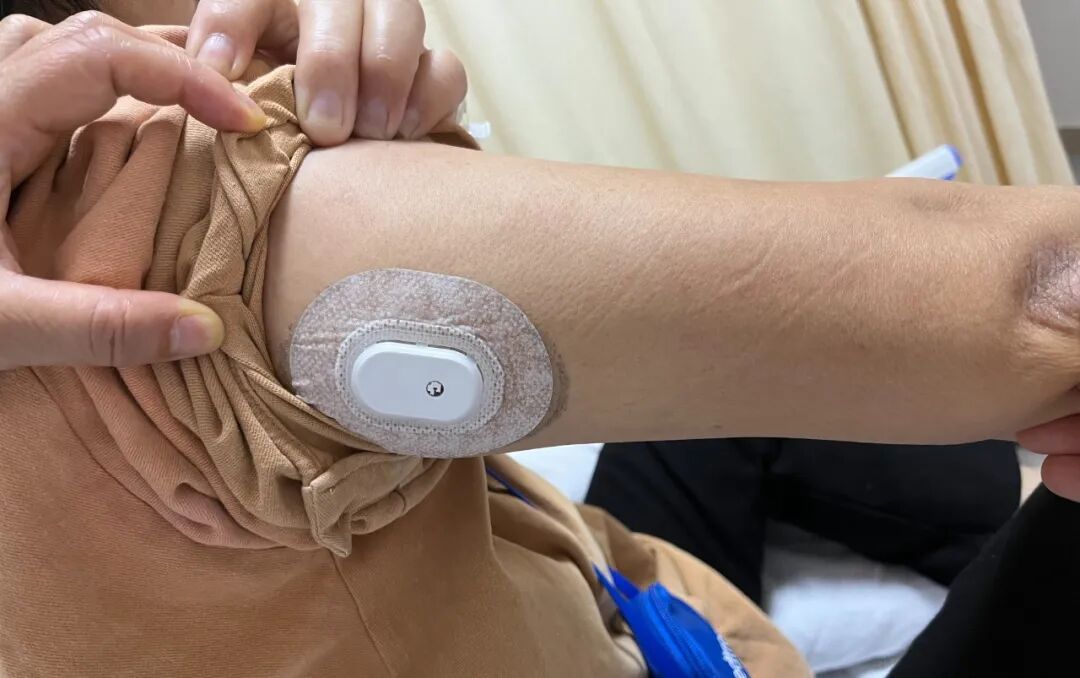 为什么要用泵打针智能控糖先锋——胰岛素泵，助您精准控糖无忧！_https://www.jmylbn.com_新闻资讯_第12张