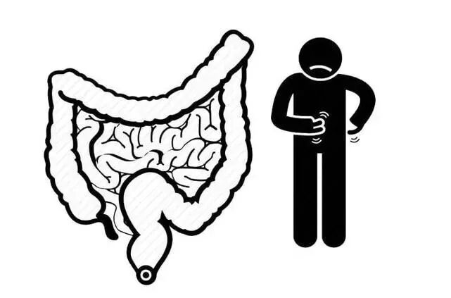 结肠灌洗怎么回事【病例分享】利用腹腔镜辅助术中灌洗技术解决结肠癌梗阻_https://www.jmylbn.com_新闻资讯_第2张
