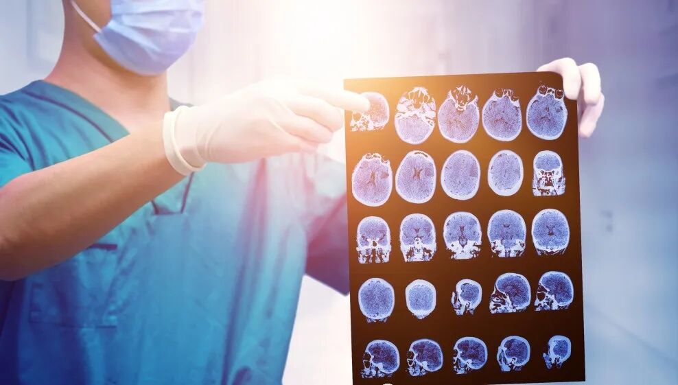 x光和dr有什么区别X线(DR)、CT、B超、核磁共振到底有什么区别，这篇文章说全了！_https://www.jmylbn.com_新闻资讯_第3张