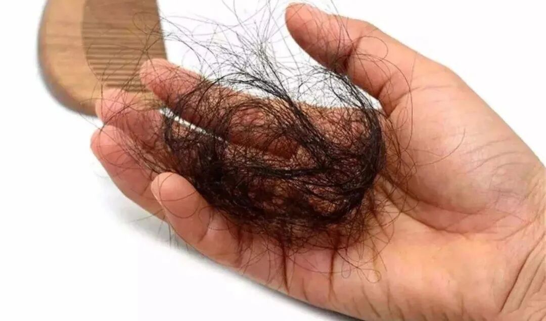 一秋肾三虚！秋季女人脱发严重，可能是这些原因！