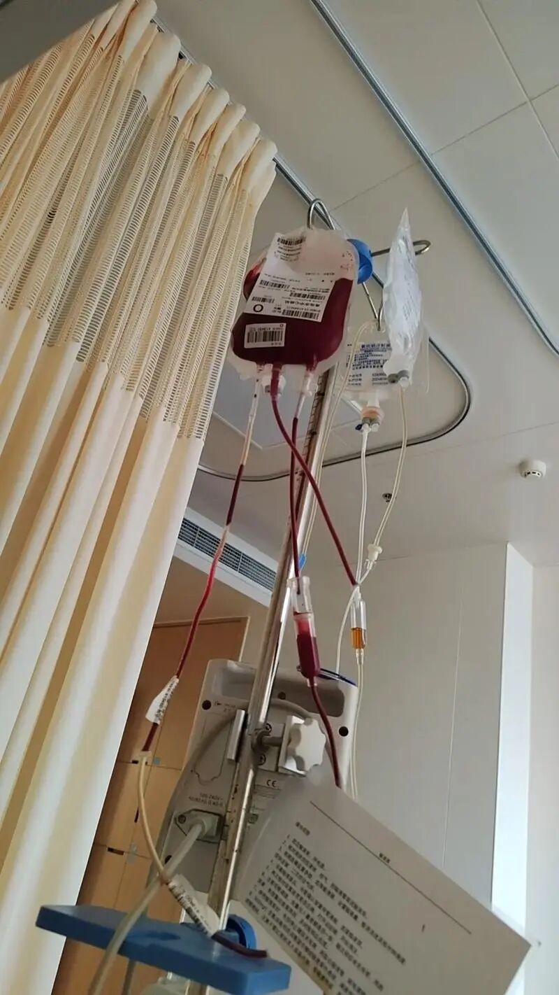 血小板660有什么危害大量输血时应同时给予血浆和血小板_https://www.jmylbn.com_新闻资讯_第1张