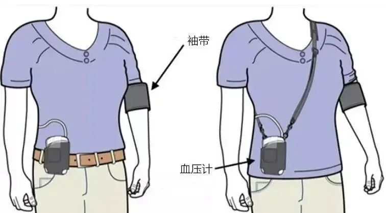 动态血压检测仪怎么看24小时动态血压监测有什么用？看完终于懂了！_https://www.jmylbn.com_新闻资讯_第3张