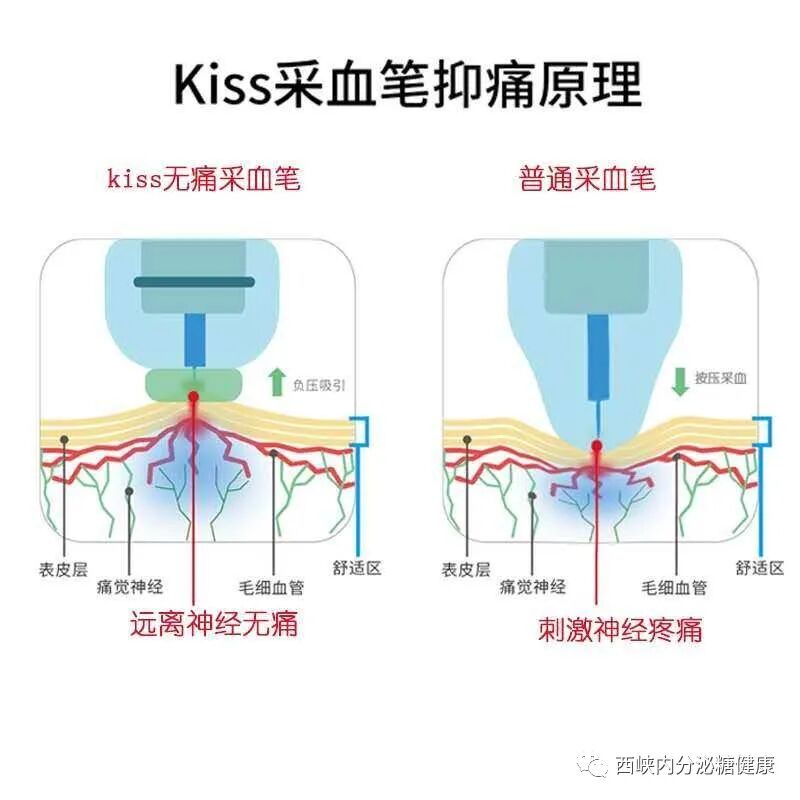 无痛采血针怎么用血糖监测扎手指真痛！无痛采血你知道吗？_https://www.jmylbn.com_新闻资讯_第14张