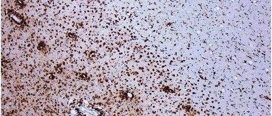 早啊，健康来了！【2022.3.1】