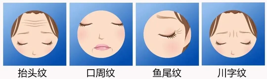 中国动态dr是什么【Dr.周的医美芳略】静态纹vs动态纹，纹路不一样思路不一样！-上海聚慕医疗器械有限公司